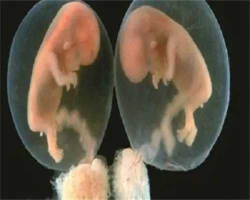 试管捐卵代怀:备孕前检查血型也很重要