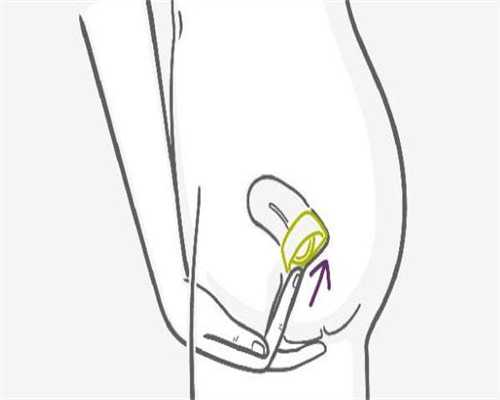 孕六周hcg下降怎么办