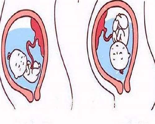 供卵机构#孕期饮食应该注意什么