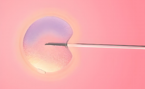 鲜胚移植与年龄因素：年龄对成功率的影响